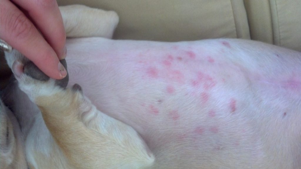 Allergic Reactions