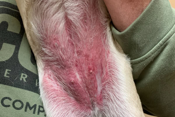 Infections-(Bacterial-or-Fungal)